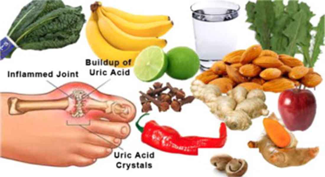 What causes high uric acid levels in the body