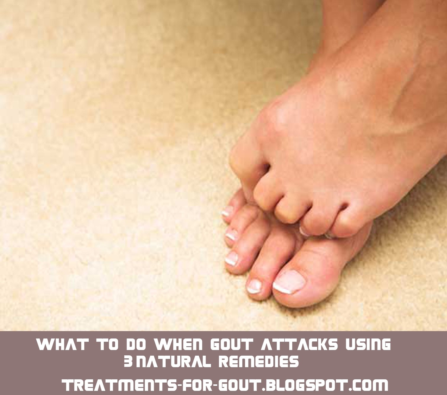 what does gout look like