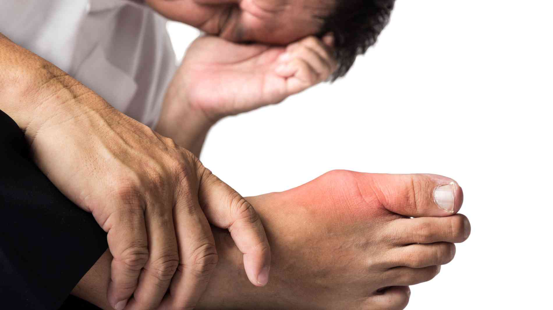 What Is Gout and How Do You Get It?
