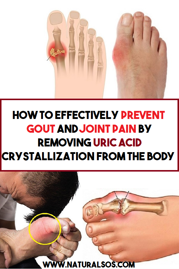 What Is Gout Feel Like
