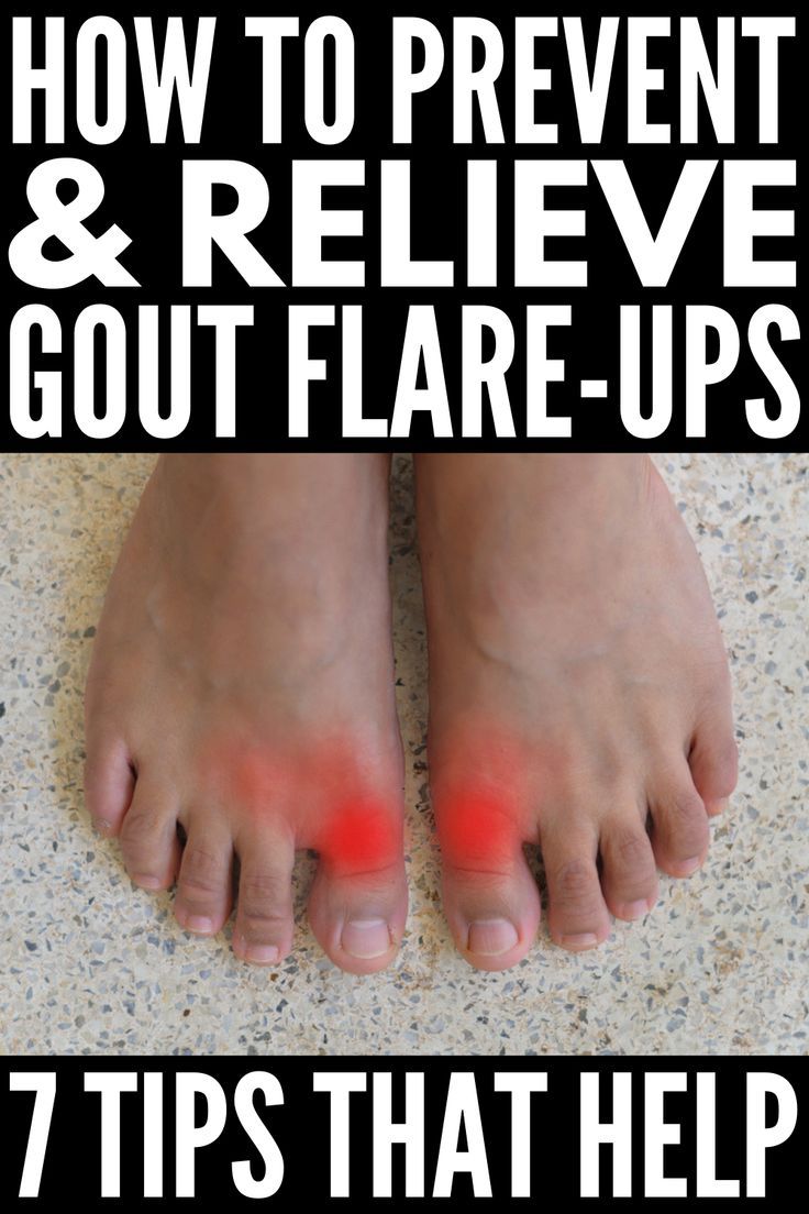 What Is Gout Pain Like In The Foot