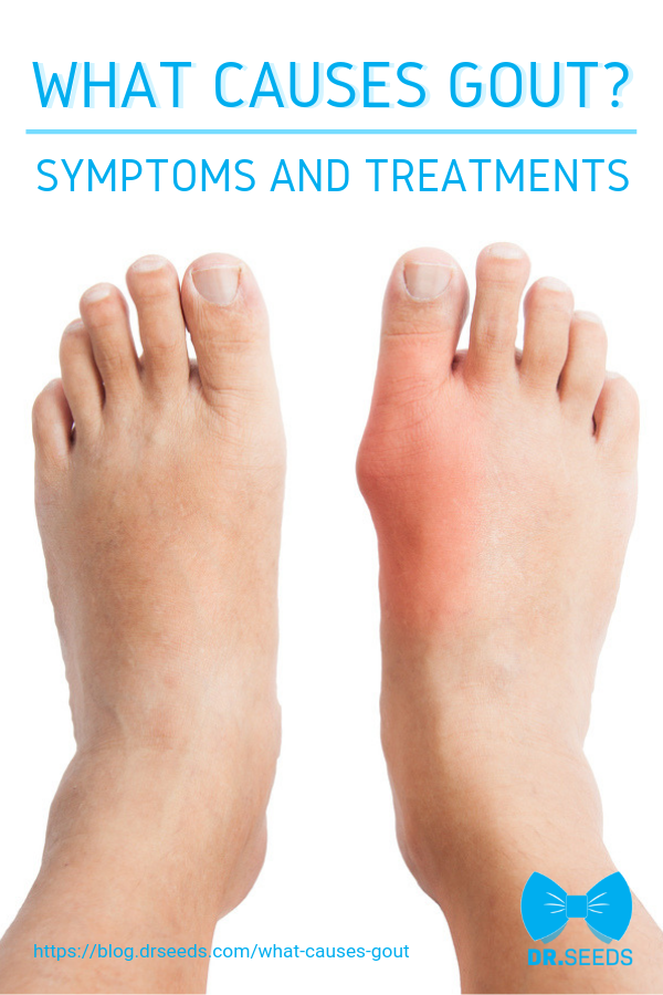 What Is Gout Pain Like In The Foot