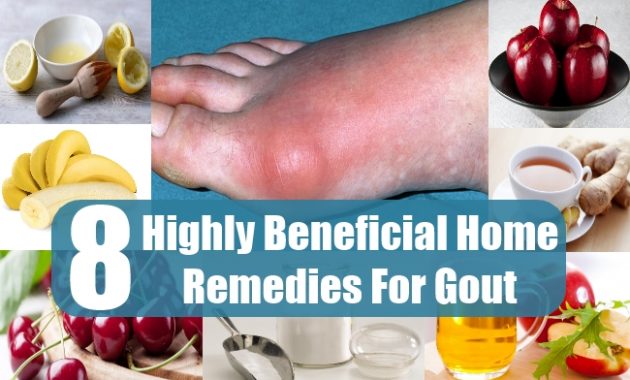 What Is Home Remedy For Gout?