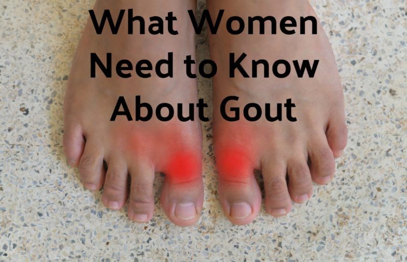What Women Need to Know About Gout